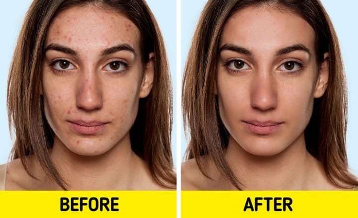 7 Things That Happen to Your Skin When You Stop Eating Dairy for One Month