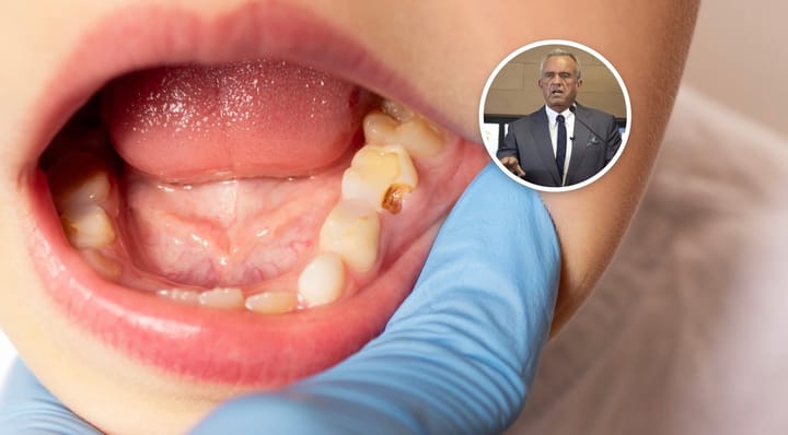 RFK Jr fluoride ban creates dental disaster costing parents nearly $10 billion in five years